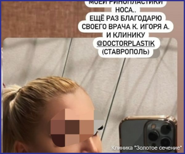 отзыв ринопластика 3.jpg