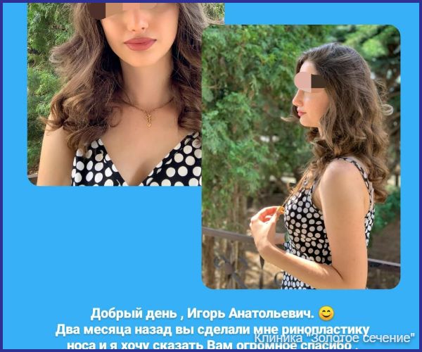отзыв ринопластика 2.jpg