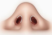 rinoplastika_close.jpg rinoplastika_close.jpg